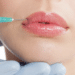 What to Know About Botox: Myths Vs Facts