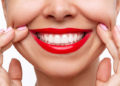 The Perfect Hollywood Smile – How To Achieve It