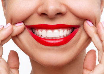 The Perfect Hollywood Smile – How To Achieve It