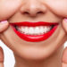 The Perfect Hollywood Smile – How To Achieve It