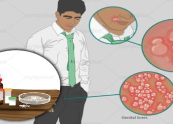 Breaking the Stigma: Exploring Herpes Medication for Effective Symptom Relief