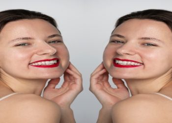 The Botox Debate: Can it Really Stop Teeth Grinding Once and For All?