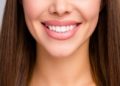 From the Silver Screen to Your Dentist’s Chair: How Hollywood Smile Sets Beauty Standards Through Aesthetic Dentistry
