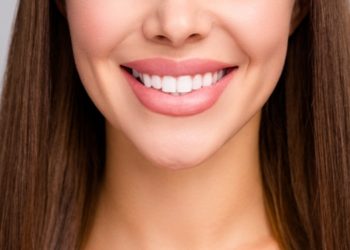 From the Silver Screen to Your Dentist’s Chair: How Hollywood Smile Sets Beauty Standards Through Aesthetic Dentistry