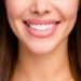 From the Silver Screen to Your Dentist’s Chair: How Hollywood Smile Sets Beauty Standards Through Aesthetic Dentistry