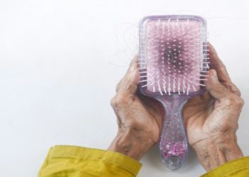 Hair brush showing hair loss and a pile of hair starnds