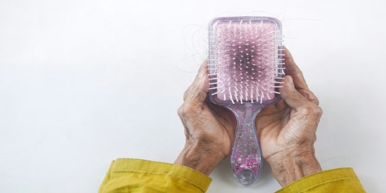 Hair brush showing hair loss and a pile of hair starnds