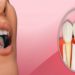Why Choose Dental Implants Newcastle for a confident Smile