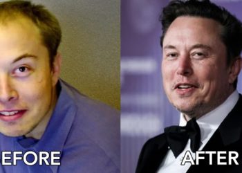 Transforming Confidence: A Comprehensive Explain to Hair Transplant Success in Turkey