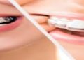 Dental Implants Middlesbrough: Expert Care at Westmount Dental Surgery