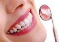 Whitening Strips