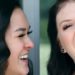 Clip-On Veneers: A Tried and Tested Review