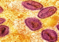 mPox virus colourised and close up