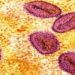 mPox virus colourised and close up