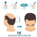 FUE Hair Transplant