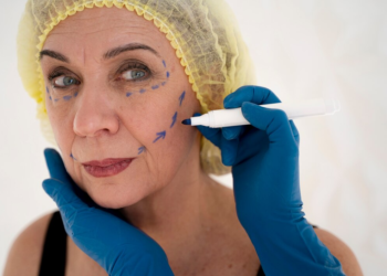 Facial Cosmetic Surgery