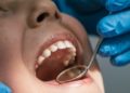 Dental Treatment in Turkey: The Affordable Solution for UK Patients
