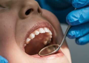 Dental Treatment in Turkey: The Affordable Solution for UK Patients