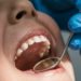 Dental Treatment in Turkey: The Affordable Solution for UK Patients