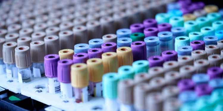 Drug Testing: Service Options Guide