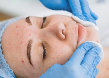 Exploring the Best Treatments for a Natural, Radiant Look