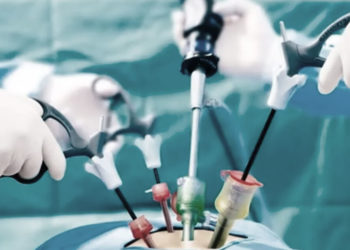 Gastric Sleeve Surgery