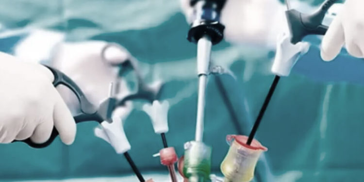 Gastric Sleeve Surgery