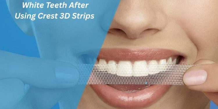3D Strips