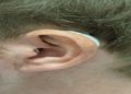 Why concert earplugs are essential for protecting your hearing