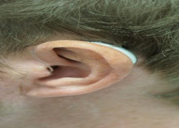 Why concert earplugs are essential for protecting your hearing