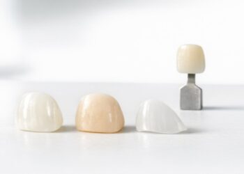 Understanding the Main Types of Dental Veneers