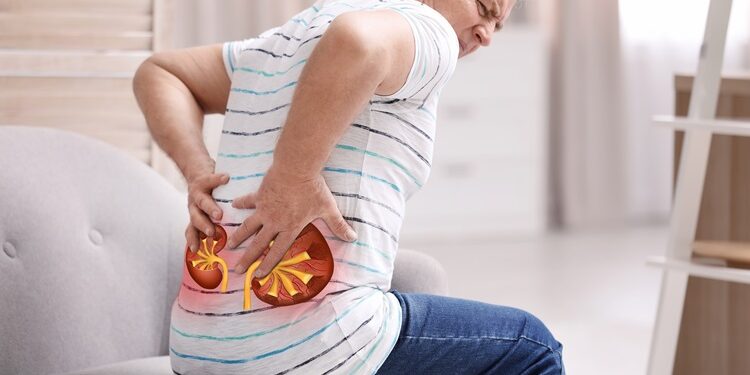 Navigating Kidney Stones: Understanding Urolithiasis and Your Options