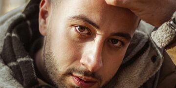 Hermest Sets the Standard for Hair Transplants in Turkey Among Global Clients