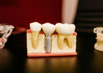 Dental Implants Turkey