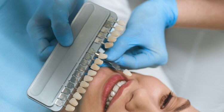 Are Veneers in Turkey Safe? What UK Patients Should Know Before Travelling