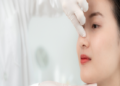 Rhinoplasty