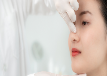 Rhinoplasty
