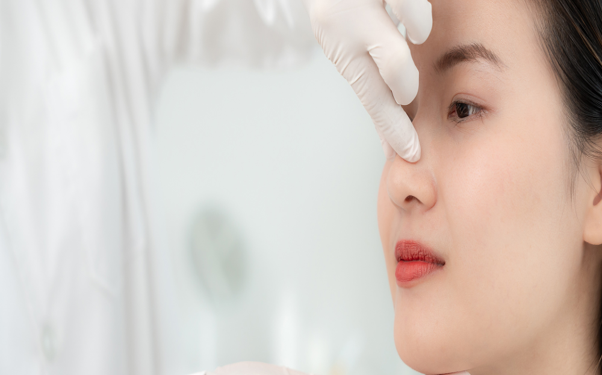 Rhinoplasty