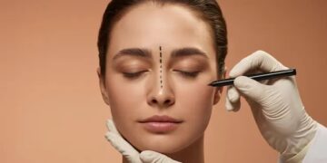 Cosmetic Surgery