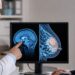 Understanding the Connection Between Breast Cancer Treatment and Neurological Health